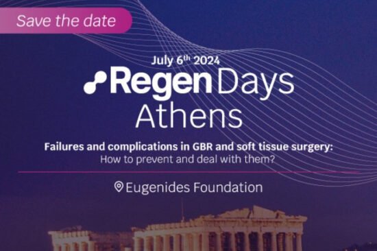 regen days